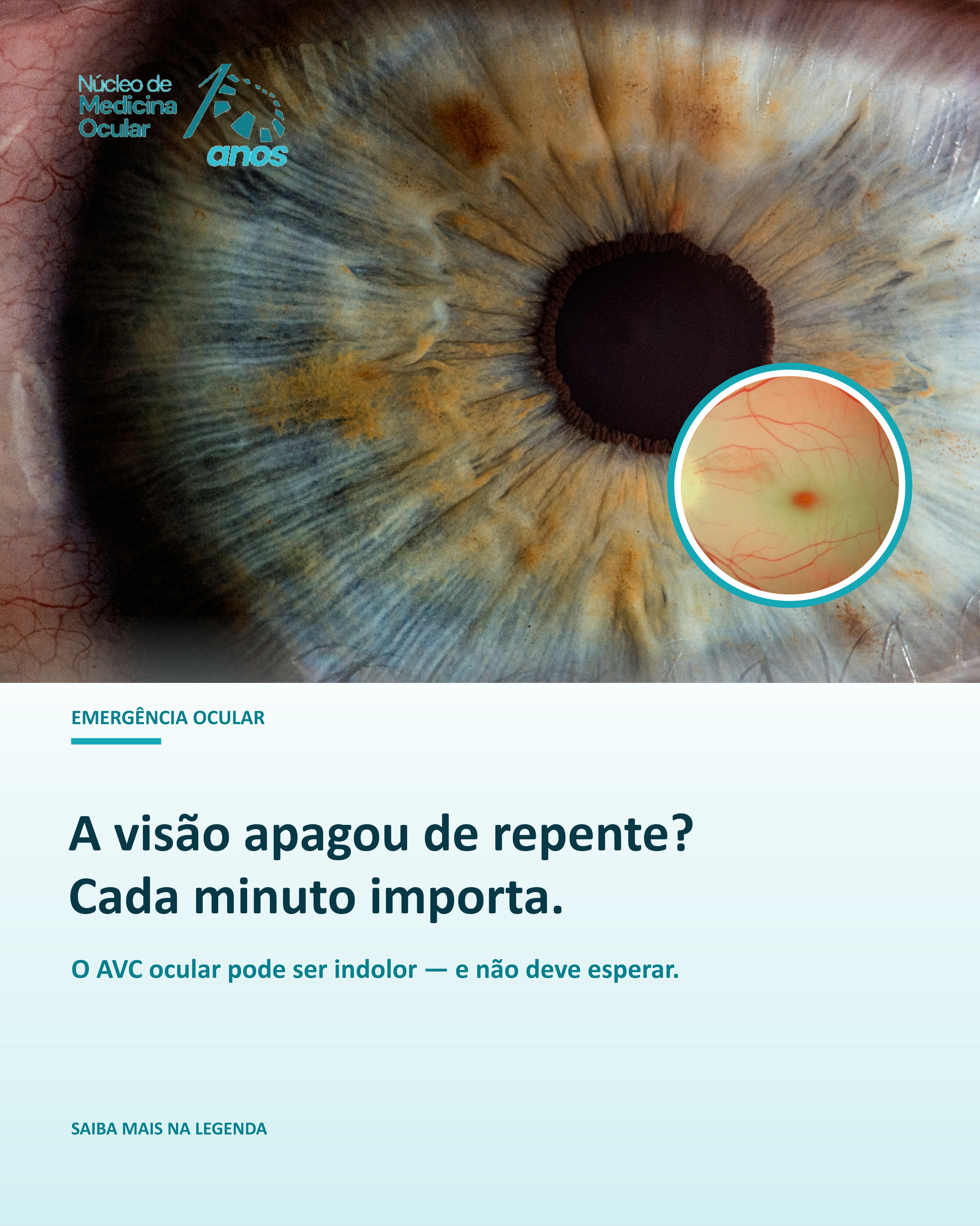 Prévia de post-01-avc-ocular.png